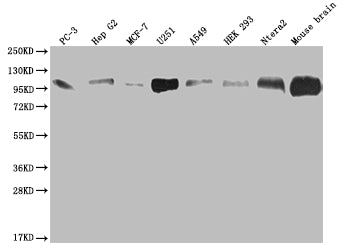 Western Blot | Positive WB detected in: PC3 whole cell lysate, HepG2 whole cell lysate, MCF-7 whole cell lysate, U251 whole cell lysate, A549 whole cell lysate, HEK293 whole cell lysate, Ntera-2 whole cell lysate, Mouse brain tissue | All lanes: ALCAM antibody at 1:2000 | Secondary | Goat polyclonal to rabbit IgG at 1/50000 dilution | Predicted band size: 66, 64, 16, 34 kDa | Observed band size: 100 kDaALCAM Recombinant Monoclonal Antibody