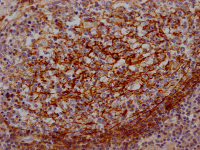 IHC image of CD55 Recombinant Monoclonal Antibody diluted at 1:100 and staining in paraffin-embedded human lung tissue performed on a Leica BondTM system. After dewaxing and hydration, antigen retrieval was mediated by high pressure in a citrate buffer (pH 6.0). Section was blocked with 10% normal goat serum 30min at RT. Then primary antibody (1% BSA) was incubated at 4℃ overnight. The primary is detected by a Goat anti-rabbit IgG polymer labeled by HRP and visualized using 0.05% DAB.