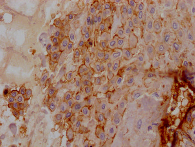 IHC image of CD55 Recombinant Monoclonal Antibody diluted at 1:100 and staining in paraffin-embedded human placenta tissue performed on a Leica BondTM system. After dewaxing and hydration, antigen retrieval was mediated by high pressure in a citrate buffer (pH 6.0). Section was blocked with 10% normal goat serum 30min at RT. Then primary antibody (1% BSA) was incubated at 4℃ overnight. The primary is detected by a Goat anti-rabbit IgG polymer labeled by HRP and visualized using 0.05% DAB.