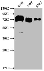 Western Blot | Positive WB detected in: A549 whole cell lysate, 293T whole cell lysate, K562 whole cell lysate | All lanes: CD55 antibody at 1:2000 | Secondary | Goat polyclonal to rabbit IgG at 1/50000 dilution | Predicted band size: 42, 49, 40, 57, 60 kDa | Observed band size: 70 kDa