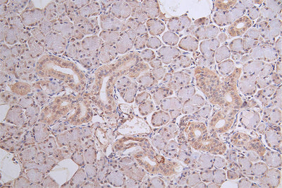 IHC image of DDB2 Recombinant Monoclonal Antibody diluted at 1:50 and staining in paraffin-embedded human salivary gland tissue performed on a Leica BondTM system. After dewaxing and hydration, antigen retrieval was mediated by high pressure in a citrate buffer (pH 6.0). Section was blocked with 10% normal goat serum 30min at RT. Then primary antibody (1% BSA) was incubated at 4°C overnight. The primary is detected by a Goat anti-rabbit polymer IgG labeled by HRP and visualized using 0.46% DAB.