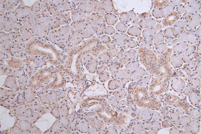 IHC image of DDB2 Recombinant Monoclonal Antibody diluted at 1:50 and staining in paraffin-embedded human salivary gland tissue performed on a Leica BondTM system. After dewaxing and hydration, antigen retrieval was mediated by high pressure in a citrate buffer (pH 6.0). Section was blocked with 10% normal goat serum 30min at RT. Then primary antibody (1% BSA) was incubated at 4°C overnight. The primary is detected by a Goat anti-rabbit polymer IgG labeled by HRP and visualized using 0.46% DAB.