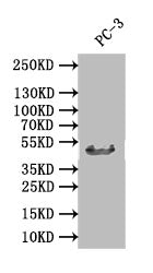 Western Blot | Positive WB detected in: PC-3 whole cell lysate | All lanes: DDB2 antibody at 1:1000 | Secondary | Goat polyclonal to rabbit IgG at 1/50000 dilution | Predicted band size: 47 kDa | Observed band size: 47 kDa