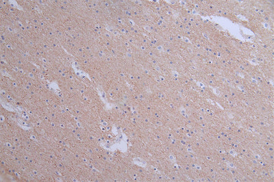 IHC image of the antibody diluted at 1:50 and staining in paraffin-embedded human brain tissue performed on a Leica BondTM system. After dewaxing and hydration, antigen retrieval was mediated by high pressure in a citrate buffer (pH 6.0). Section was blocked with 10% normal goat serum 30min at RT. Then primary antibody (1% BSA) was incubated at 4°C overnight. The primary is detected by a Goat anti-rabbit polymer IgG labeled by HRP and visualized using 0.1:50% DAB.PANX1 Recombinant Monoclonal Antibody