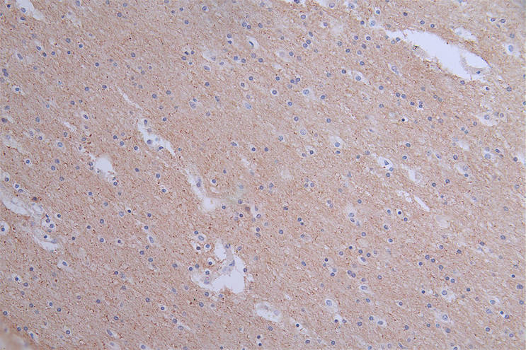 IHC image of the antibody diluted at 1:50 and staining in paraffin-embedded human brain tissue performed on a Leica BondTM system. After dewaxing and hydration, antigen retrieval was mediated by high pressure in a citrate buffer (pH 6.0). Section was blocked with 10% normal goat serum 30min at RT. Then primary antibody (1% BSA) was incubated at 4°C overnight. The primary is detected by a Goat anti-rabbit polymer IgG labeled by HRP and visualized using 0.1:50% DAB.PANX1 Recombinant Monoclonal Antibody