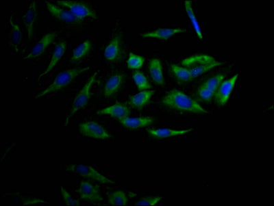 Immunofluorescence staining of Hela Cells with CYP17A1 Recombinant Monoclonal Antibody at 1:50, counter-stained with DAPI. The cells were fixed in 4% formaldehyde, permeated by 0.2% TritonX-100, and blocked in 10% normal Goat Serum. The cells were then incubated with the antibody overnight at 4℃. Nuclear DNA was labeled in blue with DAPI. The secondary antibody was FITC-conjugated AffiniPure Goat Anti-Rabbit IgG (H+L).
