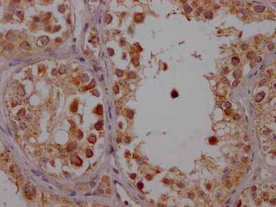 IHC image of CYP17A1 Recombinant Monoclonal Antibody diluted at 1:100 and staining in paraffin-embedded human testis tissue performed on a Leica BondTM system. After dewaxing and hydration, antigen retrieval was mediated by high pressure in a citrate buffer (pH 6.0). Section was blocked with 10% normal goat serum 30min at RT. Then primary antibody (1% BSA) was incubated at 4℃ overnight. The primary is detected by a Goat anti-rabbit IgG polymer labeled by HRP and visualized using 0.05% DAB.