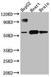 Western Blot | Positive WB detected in: HepG2 whole cell lysate, Rat Heart whole cell lysate, Rat Brain whole cell lysate | All lanes: CYP17A1 antibody at 1:1000 | Secondary | Goat polyclonal to rabbit IgG at 1/50000 dilution | Predicted band size: 58 kDa | Observed band size: 58 kDa