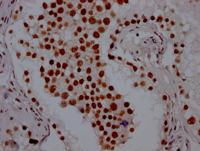 IHC image of PABPN1 Recombinant Monoclonal Antibody diluted at 1:100 and staining in paraffin-embedded human testis tissue performed on a Leica BondTM system. After dewaxing and hydration, antigen retrieval was mediated by high pressure in a citrate buffer (pH 6.0). Section was blocked with 10% normal goat serum 30min at RT. Then primary antibody (1% BSA) was incubated at 4℃ overnight. The primary is detected by a Goat anti-rabbit IgG polymer labeled by HRP and visualized using 0.05% DAB.