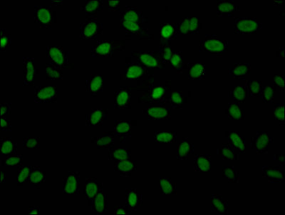 Immunofluorescence staining of Hela Cells with ALDOA Recombinant Monoclonal Antibody at 1:50, counter-stained with DAPI. The cells were fixed in 4% formaldehyde, permeated by 0.2% TritonX-100, and blocked in 10% normal Goat Serum. The cells were then incubated with the antibody overnight at 4℃. Nuclear DNA was labeled in blue with DAPI. The secondary antibody was FITC-conjugated AffiniPure Goat Anti-Rabbit IgG (H+L).ALDOA Recombinant Monoclonal Antibody