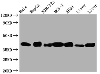Western Blot | Positive WB detected in: Hela whole cell lysate, HepG2 whole cell lysate, NIH/3T3 whole cell lysate, A549 whole cell lysate, Mouse Liver whole cell lysate, Rat Liver whole cell lysate | All lanes: Aldolase antibody at 1:1000 | Secondary | Goat polyclonal to rabbit IgG at 1/50000 dilution | Predicted band size: 40, 46 kDa | Observed band size: 40 kDaALDOA Recombinant Monoclonal Antibody