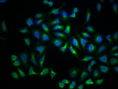 Immunofluorescence staining of Hela Cells with LDLR Recombinant Monoclonal Antibody at 1:50, counter-stained with DAPI. The cells were fixed in 4% formaldehyde, permeated by 0.2% TritonX-100, and blocked in 10% normal Goat Serum. The cells were then incubated with the antibody overnight at 4℃. Nuclear DNA was labeled in blue with DAPI. The secondary antibody was FITC-conjugated AffiniPure Goat Anti-Rabbit IgG (H+L).LDLR Recombinant Monoclonal Antibody