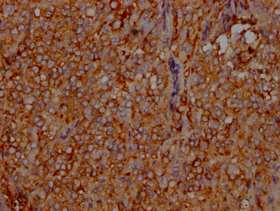 IHC image of the antibody diluted at 1:100 and staining in paraffin-embedded human adrenal gland tissue performed on a Leica BondTM system. After dewaxing and hydration, antigen retrieval was mediated by high pressure in a citrate buffer (pH 6.0). Section was blocked with 10% normal goat serum 30min at RT. Then primary antibody (1% BSA) was incubated at 4℃ overnight. The primary is detected by a Goat anti-rabbit IgG polymer labeled by HRP and visualized using 0.05% DAB.LDLR Recombinant Monoclonal Antibody