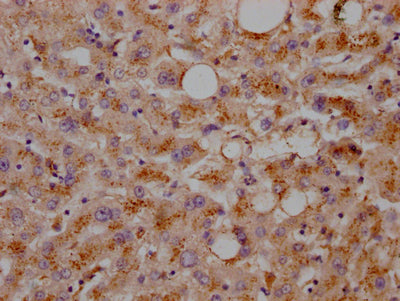 IHC image of LDLR Recombinant Monoclonal Antibody diluted at 1:100 and staining in paraffin-embedded human liver tissue performed on a Leica BondTM system. After dewaxing and hydration, antigen retrieval was mediated by high pressure in a citrate buffer (pH 6.0). Section was blocked with 10% normal goat serum 30min at RT. Then primary antibody (1% BSA) was incubated at 4℃ overnight. The primary is detected by a Goat anti-rabbit IgG polymer labeled by HRP and visualized using 0.05% DAB.LDLR Recombinant Monoclonal Antibody
