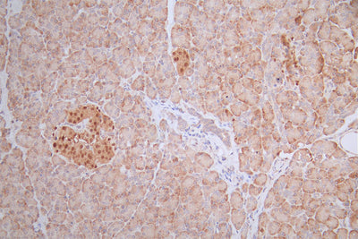 IHC image of the antibody diluted at 1:100 and staining in paraffin-embedded human pancreati tissue performed on a Leica BondTM system. After dewaxing and hydration, antigen retrieval was mediated by high pressure in a citrate buffer (pH 6.0). Section was blocked with 10% normal goat serum 30min at RT. Then primary antibody (1% BSA) was incubated at 4°C overnight. The primary is detected by a Goat anti-rabbit polymer IgG labeled by HRP and visualized using 0.55% DAB.PAX6 Recombinant Monoclonal Antibody
