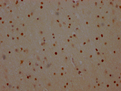 IHC image of PARP1 Recombinant Monoclonal Antibody diluted at 1:100 and staining in paraffin-embedded human brain tissue performed on a Leica BondTM system. After dewaxing and hydration, antigen retrieval was mediated by high pressure in a citrate buffer (pH 6.0). Section was blocked with 10% normal goat serum 30min at RT. Then primary antibody (1% BSA) was incubated at 4℃ overnight. The primary is detected by a Goat anti-rabbit IgG polymer labeled by HRP and visualized using 0.05% DAB.