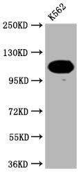 Western Blot | Positive WB detected in: K562 whole cell lysate | All lanes: PARP antibody at 1:2000 | Secondary | Goat polyclonal to rabbit IgG at 1/50000 dilution | Predicted band size: 114 KDa | Observed band size: 114 kDa