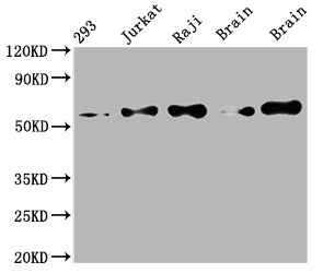 Western Blot | Positive WB detected in: 293 whole cell lysate, Jurkat whole cell lysate, Raji whole cell lysate, Mouse brain tissue, Rat brain tissue | All lanes: PAK2 antibody at 1:2000 | Secondary | Goat polyclonal to rabbit IgG at 1/50000 dilution | Predicted band size: 59 kDa | Observed band size: 59 kDaPAK2 Recombinant Monoclonal Antibody