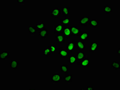 Immunofluorescence staining of Hela cells with Phospho-NFE2L2 (S40) Recombinant Monoclonal Antibody at 1:100,counter-stained with DAPI. The cells were fixed in 4% formaldehyde, permeabilized using 0.2% Triton X-100 and blocked in 10% normal Goat Serum. The cells were then incubated with the antibody overnight at 4℃. The secondary antibody was Alexa Fluor 488-congugated AffiniPure Goat Anti-Rabbit IgG (H+L).Phospho-NFE2L2 (S40) Recombinant Monoclonal Antibody