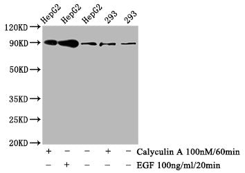 Western Blot | Positive WB detected in HepG2 whole cell lysate,293 whole cell lysate(treated with Calyculin A or EGF) | All lanes Phospho-NFE2L2 antibody at 0.8μg/ml | Secondary | Goat polyclonal to rabbit IgG at 1/50000 dilution | Predicted band size: 90 KDa | Observed band size: 90 KDaPhospho-NFE2L2 (S40) Recombinant Monoclonal Antibody