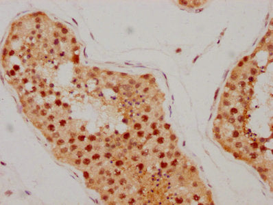 IHC image of ATM Recombinant Monoclonal Antibody diluted at 1:205 and staining in paraffin-embedded human testis tissue performed on a Leica BondTM system. After dewaxing and hydration, antigen retrieval was mediated by high pressure in a citrate buffer (pH 6.0). Section was blocked with 10% normal goat serum 30min at RT. Then primary antibody (1% BSA) was incubated at 4℃ overnight. The primary is detected by a biotinylated secondary antibody and visualized using an HRP conjugated SP system.ATM Recombinant Monoclonal Antibody