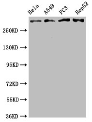 Western Blot | Positive WB detected in: Hela whole cell lysate, A549 whole cell lysate, PC3 whole cell lysate, HepG2 whole cell lysate | All lanes: ATM antibody at 2.05μg/ml | Secondary | Goat polyclonal to rabbit IgG at 1/50000 dilution | Predicted band size: 350 KDa | Observed band size: 350 KDaATM Recombinant Monoclonal Antibody
