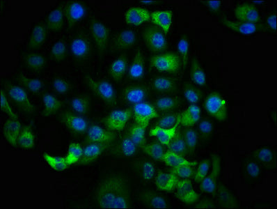Immunofluorescence staining of Hela cells with Phospho-RPS6KA1 (T359+S363) Recombinant Monoclonal Antibody at 1:100,counter-stained with DAPI. The cells were fixed in 4% formaldehyde, permeabilized using 0.2% Triton X-100 and blocked in 10% normal Goat Serum. The cells were then incubated with the antibody overnight at 4℃. The secondary antibody was Alexa Fluor 488-congugated AffiniPure Goat Anti-Rabbit IgG (H+L).Phospho-RPS6KA1 (T359+S363) Recombinant Monoclonal Antibody
