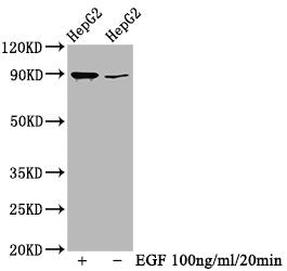 Western Blot | Positive WB detected in HepG2 whole cell lysate(treated with EGF or not) | All lanes Phospho-RPS6KA1 antibody at 0.69μg/ml | Secondary | Goat polyclonal to rabbit IgG at 1/50000 dilution | Predicted band size: 90 KDa | Observed band size: 90 KDaPhospho-RPS6KA1 (T359+S363) Recombinant Monoclonal Antibody