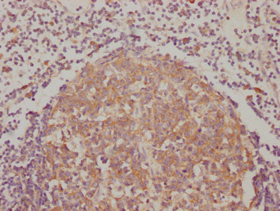IHC image of BAK1 Recombinant Monoclonal Antibody diluted at 1:90 and staining in paraffin-embedded human lymph node tissue performed on a Leica BondTM system. After dewaxing and hydration, antigen retrieval was mediated by high pressure in a citrate buffer (pH 6.0). Section was blocked with 10% normal goat serum 30min at RT. Then primary antibody (1% BSA) was incubated at 4℃ overnight. The primary is detected by a biotinylated secondary antibody and visualized using an HRP conjugated SP system.BAK1 Recombinant Monoclonal Antibody