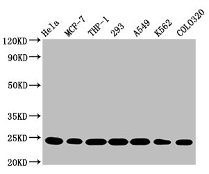 Western Blot | Positive WB detected in: Hela whole cell lysate, MCF-7 whole cell lysate, THP-1 whole cell lysate, 293 whole cell lysate, A549 whole cell lysate, K562 whole cell lysate, Colo320 whole cell lysate | All lanes: BAK1 antibody at 0.9μg/ml | Secondary | Goat polyclonal to rabbit IgG at 1/50000 dilution | Predicted band size: 24, 17 KDa | Observed band size: 24 KDaBAK1 Recombinant Monoclonal Antibody