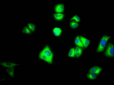 Immunofluorescence staining of Hela Cells with PKM Recombinant Monoclonal Antibody at 1:50, counter-stained with DAPI. The cells were fixed in 4% formaldehyde, permeated by 0.2% TritonX-100, and blocked in 10% normal Goat Serum. The cells were then incubated with the antibody overnight at 4℃. Nuclear DNA was labeled in blue with DAPI. The secondary antibody was FITC-conjugated AffiniPure Goat Anti-Rabbit IgG (H+L).PKM Recombinant Monoclonal Antibody