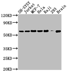 Western Blot | Positive WB detected in: SH-SY5Y whole cell lysate, Jurkat whole cell lysate, MCF-7 whole cell lysate, Hela whole cell lysate, Raji whole cell lysate, 293 whole cell lysate, Mouse brain tissue | All lanes: PKM antibody at 1:2000 | Secondary | Goat polyclonal to rabbit IgG at 1/50000 dilution | Predicted band size: 58, 59, 57 kDa | Observed band size: 58 kDaPKM Recombinant Monoclonal Antibody