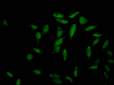 Immunofluorescence staining of Hela Cells with MAPK14 Recombinant Monoclonal Antibody at 1:50, counter-stained with DAPI. The cells were fixed in 4% formaldehyde, permeated by 0.2% TritonX-100, and blocked in 10% normal Goat Serum. The cells were then incubated with the antibody overnight at 4℃. Nuclear DNA was labeled in blue with DAPI. The secondary antibody was FITC-conjugated AffiniPure Goat Anti-Rabbit IgG (H+L).