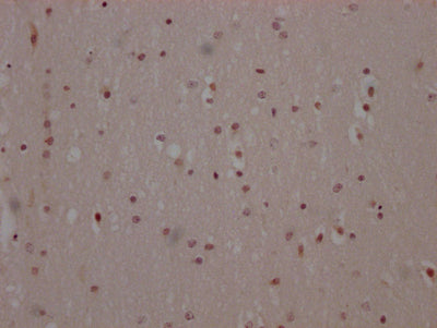 IHC image of MAPK14 Recombinant Monoclonal Antibody diluted at 1:100 and staining in paraffin-embedded human brain tissue performed on a Leica BondTM system. After dewaxing and hydration, antigen retrieval was mediated by high pressure in a citrate buffer (pH 6.0). Section was blocked with 10% normal goat serum 30min at RT. Then primary antibody (1% BSA) was incubated at 4℃ overnight. The primary is detected by a Goat anti-rabbit IgG polymer labeled by HRP and visualized using 0.05% DAB.