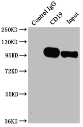 Immunoprecipitating CD19 in Raji whole cell lysate | Lane 1: Rabbit control IgG instead of CD19 Recombinant Monoclonal Antibody in Raji whole cell lysate. | For western blotting,a HRP-conjugated Protein G antibody was used as the secondary antibody (1/2000) | Lane 2: CD19 Recombinant Monoclonal Antibody(2µg)+ Raji whole cell lysate(500µg) | Lane 3: Raji whole cell lysate (10µg)CD19 Recombinant Monoclonal Antibody