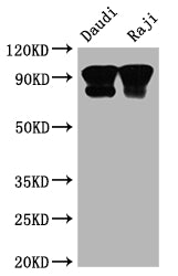 Western Blot | Positive WB detected in: Daudi whole cell lysate, Raji whole cell lysate | All lanes: CD19 antibody at 1:2000 | Secondary | Goat polyclonal to rabbit IgG at 1/50000 dilution | Predicted band size: 62 kDa | Observed band size: 95 kDa