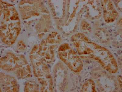 IHC image of CASP2 Recombinant Monoclonal Antibody diluted at 1:100 and staining in paraffin-embedded human kidney tissue performed on a Leica BondTM system. After dewaxing and hydration, antigen retrieval was mediated by high pressure in a citrate buffer (pH 6.0). Section was blocked with 10% normal goat serum 30min at RT. Then primary antibody (1% BSA) was incubated at 4℃ overnight. The primary is detected by a Goat anti-rabbit IgG polymer labeled by HRP and visualized using 0.05% DAB.