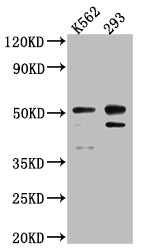 Western Blot | Positive WB detected in: K562 whole cell lysate, 293 whole cell lysate | All lanes: Caspase-2 antibody at 1:1000 | Secondary | Goat polyclonal to rabbit IgG at 1/50000 dilution | Predicted band size: 51, 35, 11 kDa | Observed band size: 51 kDa
