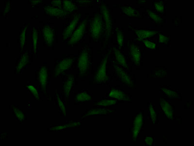 Immunofluorescence staining of Hela Cells with MAD2L2 Recombinant Monoclonal Antibody at 1:50, counter-stained with DAPI. The cells were fixed in 4% formaldehyde, permeated by 0.2% TritonX-100, and blocked in 10% normal Goat Serum. The cells were then incubated with the antibody overnight at 4℃. Nuclear DNA was labeled in blue with DAPI. The secondary antibody was FITC-conjugated AffiniPure Goat Anti-Rabbit IgG (H+L).MAD2L2 Recombinant Monoclonal Antibody