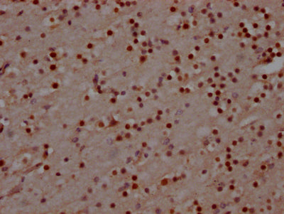 IHC image of MAD2L2 Recombinant Monoclonal Antibody diluted at 1:100 and staining in paraffin-embedded human brain tissue performed on a Leica BondTM system. After dewaxing and hydration, antigen retrieval was mediated by high pressure in a citrate buffer (pH 6.0). Section was blocked with 10% normal goat serum 30min at RT. Then primary antibody (1% BSA) was incubated at 4℃ overnight. The primary is detected by a Goat anti-rabbit IgG polymer labeled by HRP and visualized using 0.05% DAB.MAD2L2 Recombinant Monoclonal Antibody