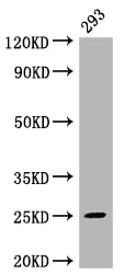 Western Blot | Positive WB detected in: 293 whole cell lysate | All lanes: Mad2L2 antibody at 1:2000 | Secondary | Goat polyclonal to rabbit IgG at 1/50000 dilution | Predicted band size: 25 kDa | Observed band size: 25 kDaMAD2L2 Recombinant Monoclonal Antibody