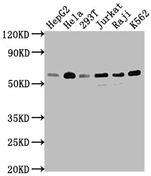 Western Blot | Positive WB detected in: HepG2 whole cell lysate, Hela whole cell lysate, 293T whole cell lysate, Jurkat whole cell lysate, Raji whole cell lysate, K562 whole cell lysate | All lanes: TRAF2 antibody at 1:1500 | Secondary | Goat polyclonal to rabbit IgG at 1/50000 dilution | Predicted band size: 56, 62, 55, 54 kDa | Observed band size: 56 kDa