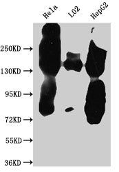 Western Blot | Positive WB detected in: Hela whole cell lysate, L02 whole cell lysate, HepG2 whole cell lysate | All lanes: EGFR antibody at 1:1000 | Secondary | Goat polyclonal to rabbit IgG at 1/50000 dilution | Predicted band size: 135, 45, 78, 70 kDa | Observed band size: 150 kDa