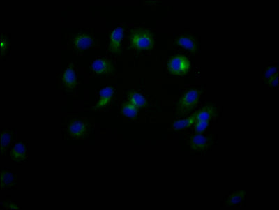 Immunofluorescence staining of MCF7 Cells with CD47 Recombinant Monoclonal Antibody at 1:50, counter-stained with DAPI. The cells were fixed in 4% formaldehyde, permeated by 0.2% TritonX-100, and blocked in 10% normal Goat Serum. The cells were then incubated with the antibody overnight at 4℃. Nuclear DNA was labeled in blue with DAPI. The secondary antibody was FITC-conjugated AffiniPure Goat Anti-Rabbit IgG (H+L).CD47 Recombinant Monoclonal Antibody
