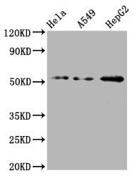 Western Blot | Positive WB detected in: Hela whole cell lysate, A549 whole cell lysate, HepG2 whole cell lysate | All lanes: CD47 antibody at 1:2000 | Secondary | Goat polyclonal to rabbit IgG at 1/50000 dilution | Predicted band size: 36, 32, 34 kDa | Observed band size: 55 kDaCD47 Recombinant Monoclonal Antibody