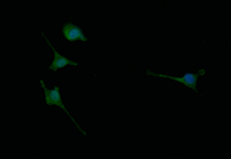 Immunofluorescence staining of SH-SY5Y with CHAT Recombinant Monoclonal Antibody at 1:30, counter-stained with DAPI. The cells were fixed in 4% formaldehyde and blocked in 10% normal Goat Serum. The cells were then incubated with the antibody overnight at 4°C. The secondary antibody was Alexa Fluor 498-congugated AffiniPure Goat Anti-Rabbit IgG(H+L).