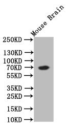 Western Blot | Positive WB detected in: Mouse Brain tissue lysate | All lanes: CHAT antibody at 1:500 | Secondary | Goat polyclonal to rabbit IgG at 1/50000 dilution | Predicted band size: 70 kDa | Observed band size: 70 kDa