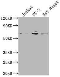 Western Blot | Positive WB detected in: Jurkat whole cell lysate, PC-3 whole cell lysate, Rat Heart tissue | All lanes: E2F1 antibody at 1:2000 | Secondary | Goat polyclonal to rabbit IgG at 1/50000 dilution | Predicted band size: 47 kDa | Observed band size: 60 kDa