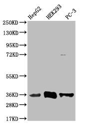Western Blot | Positive WB detected in: HepG2 whole cell lysate, HEK293 whole cell lysate, PC-3 whole cell lysate | All lanes: NTHL1 antibody at 1:1000 | Secondary | Goat polyclonal to rabbit IgG at 1/50000 dilution | Predicted band size: 35, 34, 33 kDa | Observed band size: 35 kDaNTHL1 Recombinant Monoclonal Antibody