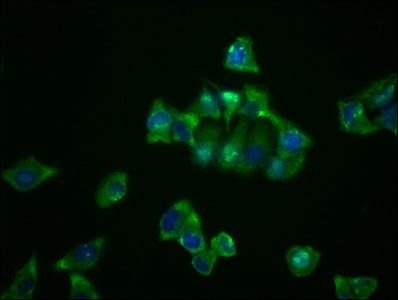 Immunofluorescence staining of Hela cells with NDRG1 Recombinant Monoclonal Antibody at 1:23, counter-stained with DAPI. The cells were fixed in 4% formaldehyde, permeabilized using 0.2% Triton X-100 and blocked in 10% normal Goat Serum. The cells were then incubated with the antibody overnight at 4℃. The secondary antibody was Alexa Fluor 488-congugated AffiniPure Goat Anti-Rabbit IgG (H+L).NDRG1 Recombinant Monoclonal Antibody